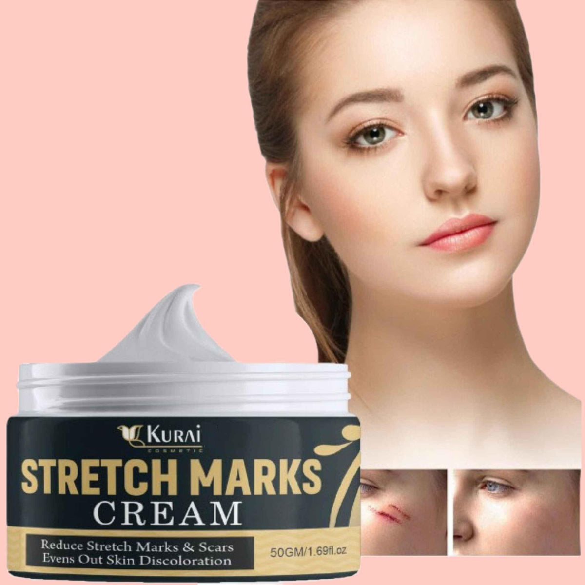 Stretch Marks Removal Cream shophina
