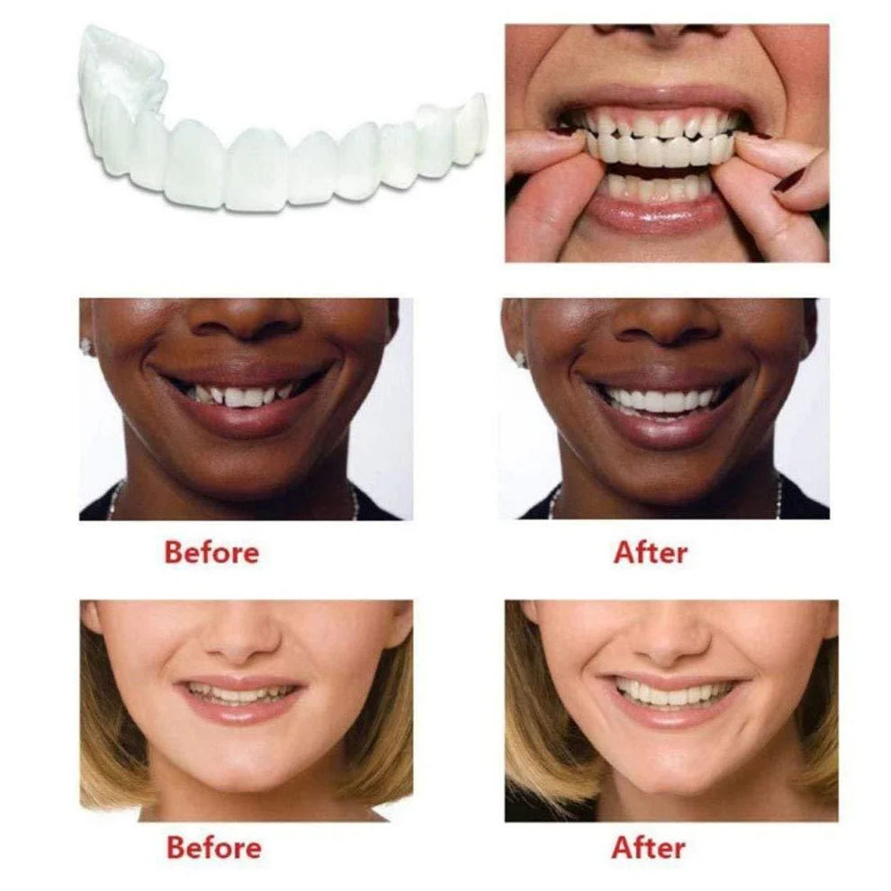 ADJUSTABLE SNAP-ON DENTURES (BUY 1 GET 1 FREE)